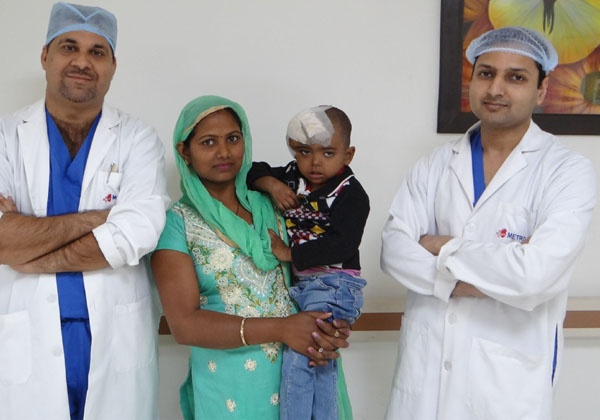 मेट्रो अस्पताल में हुई 4 वर्षीय बच्चे की जटिल ब्रेन ट्यूमर सर्जरी